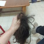 התרת קשרים בפאות